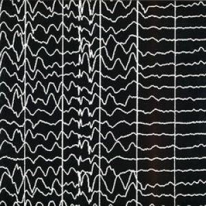 SEIZURE N. 10